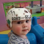 baby_bear_cranial_band_5_1-1-scaled-1.jpg